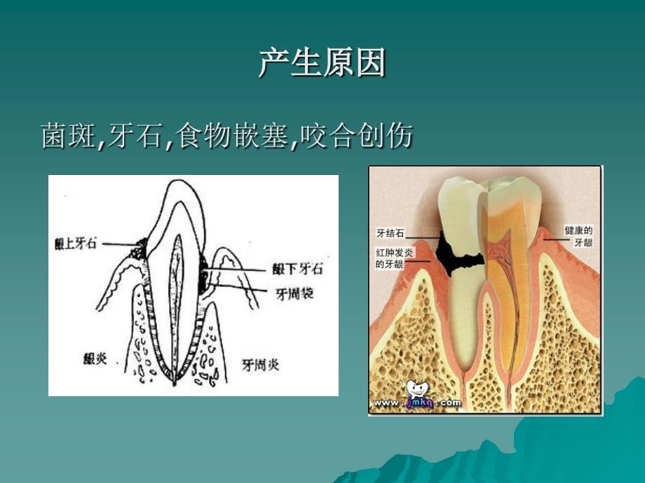 常见口腔问题PPT课件_第5页