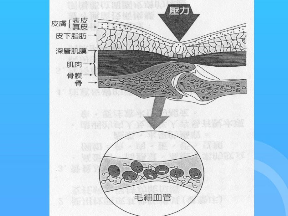 -压疮危险因素PPT课件_第5页