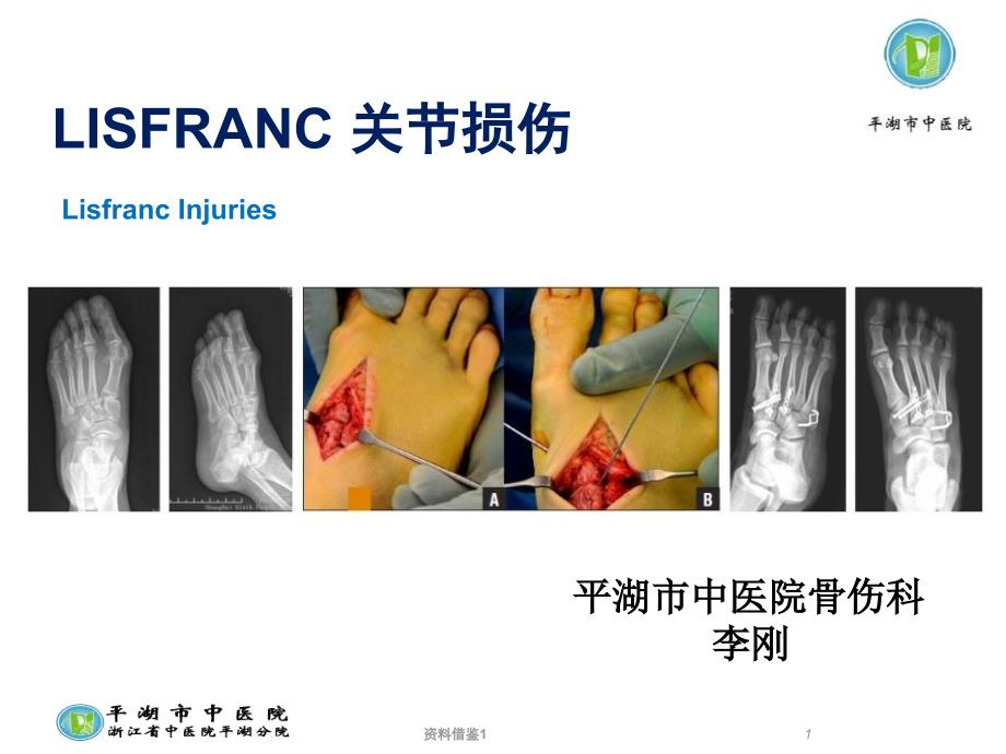 Lisfranc损伤的诊断与治疗策略行业荟萃_第1页