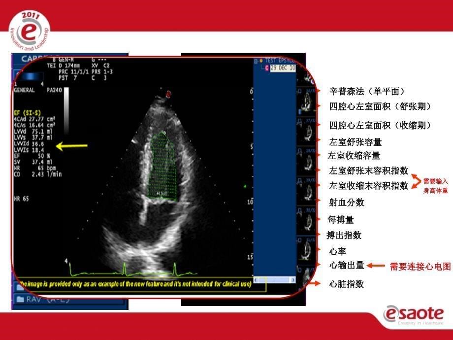 心脏测量菜单.PPT_第5页