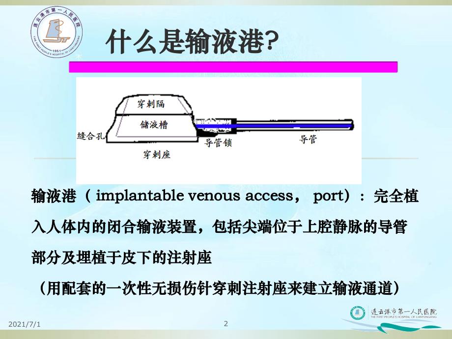 输液港PPT课件_第2页