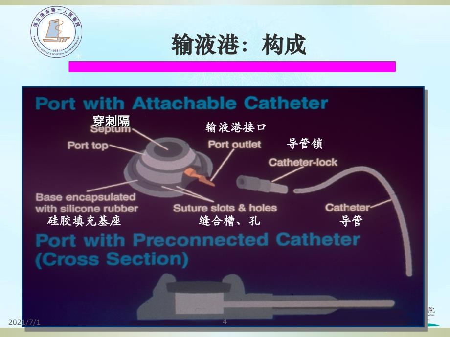 输液港PPT课件_第4页