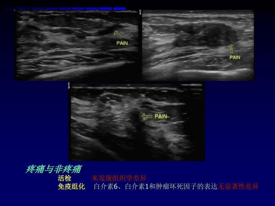 乳腺超声规范报告和BIRADS分级_第5页