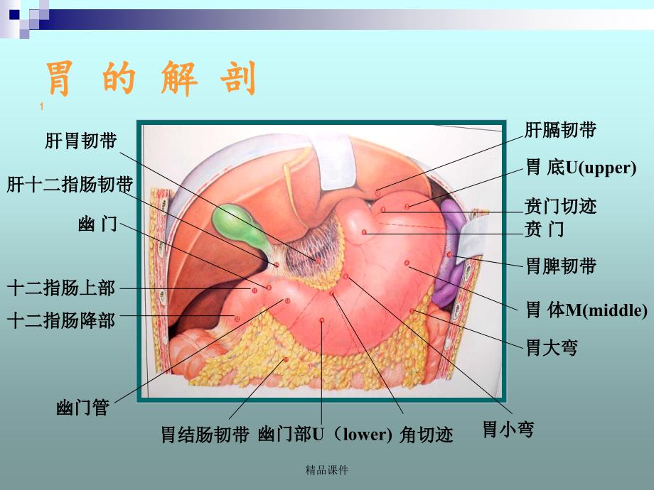 胃十二指肠溃疡急性穿孔课件_第2页