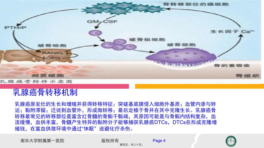 乳腺癌骨转移8133_第4页