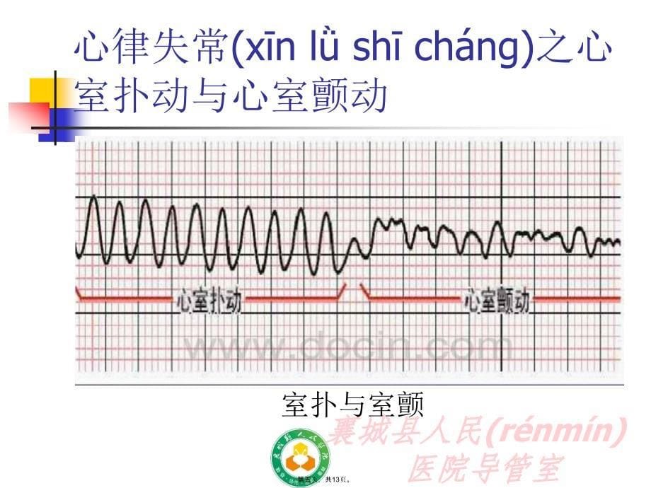 心室扑动与心室颤动要点说课材料_第5页