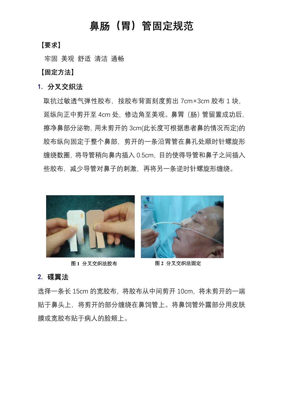 鼻肠(胃)管固定规范2.doc3.doc4_第1页