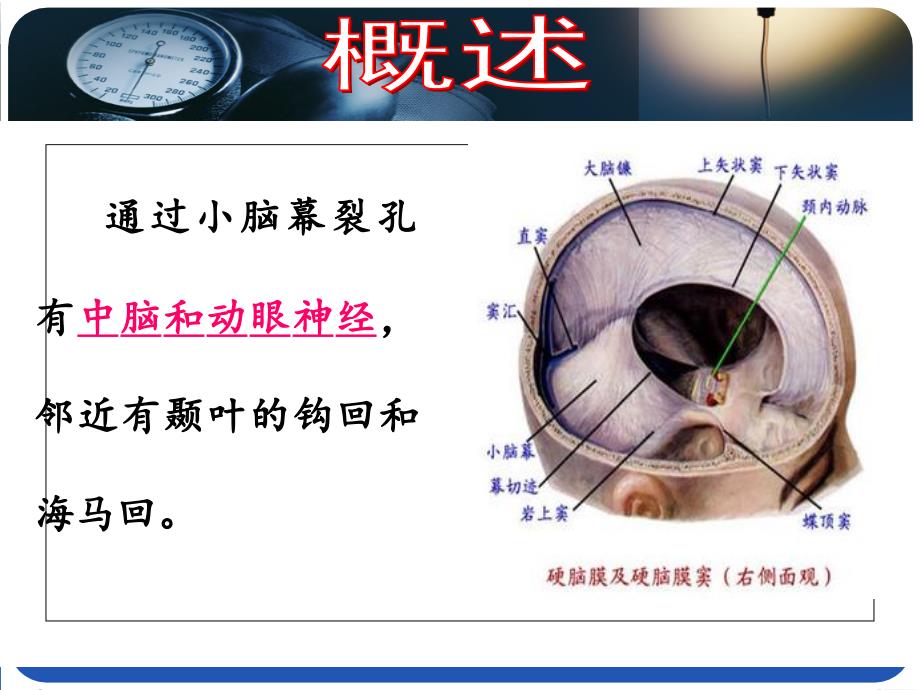 WH脑疝患者护理_第4页