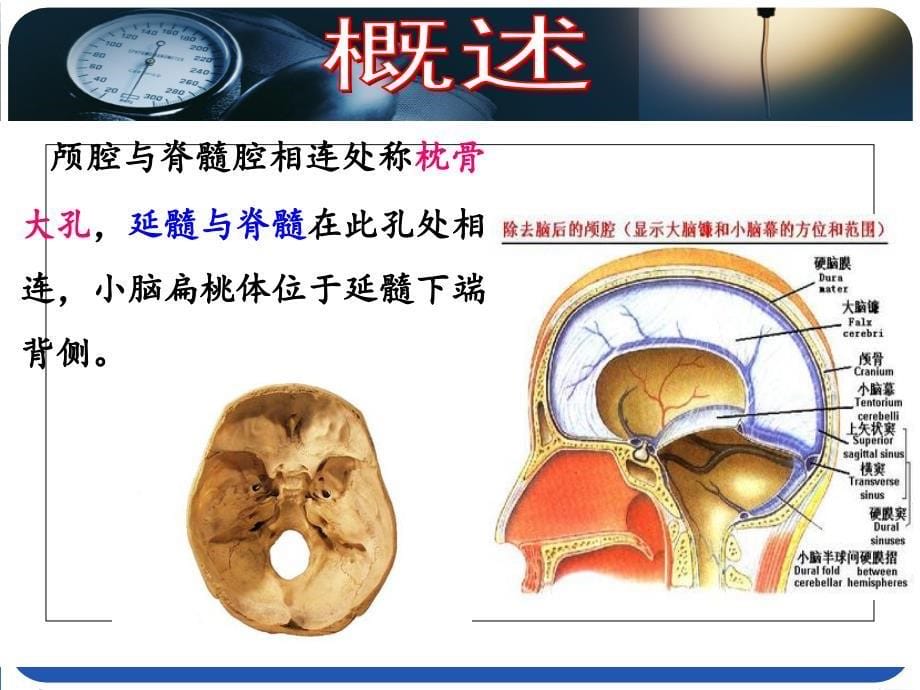 WH脑疝患者护理_第5页