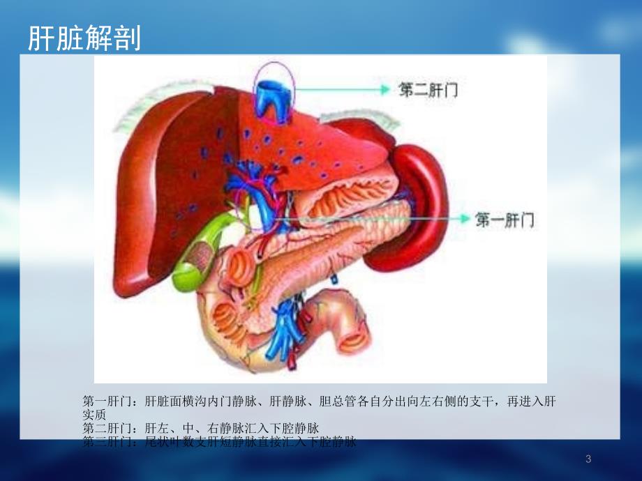 布加综合征课件_第3页