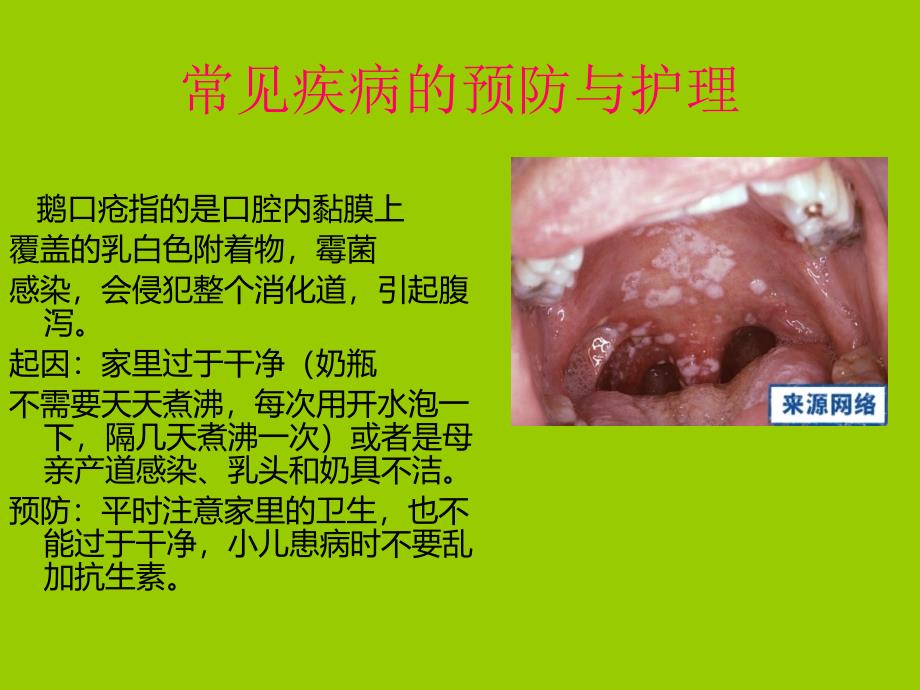 婴幼儿常见疾病预防与护理-PPT课件.ppt_第4页