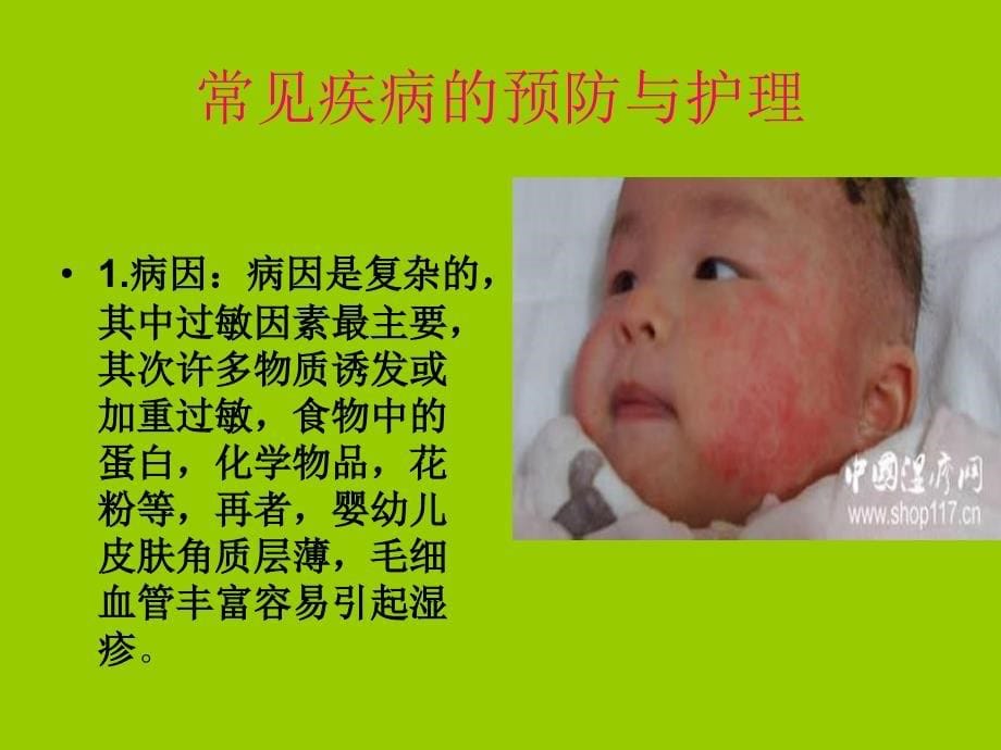 婴幼儿常见疾病预防与护理-PPT课件.ppt_第5页