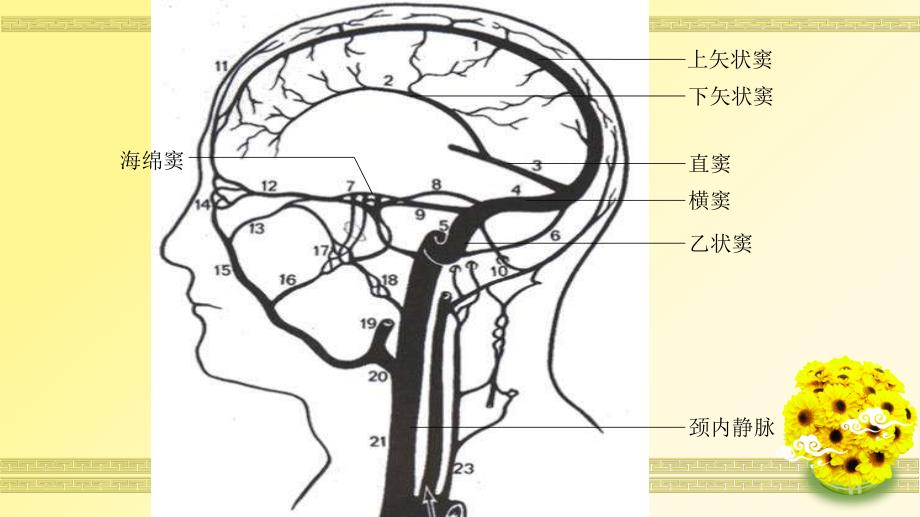 一例颅内静脉窦血栓形成病人的护理ppt课件文档资料_第4页