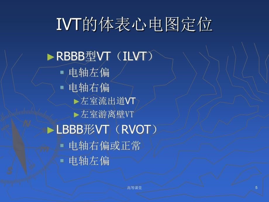 室性心动过速的体表心电图定位【特制荟萃】_第5页