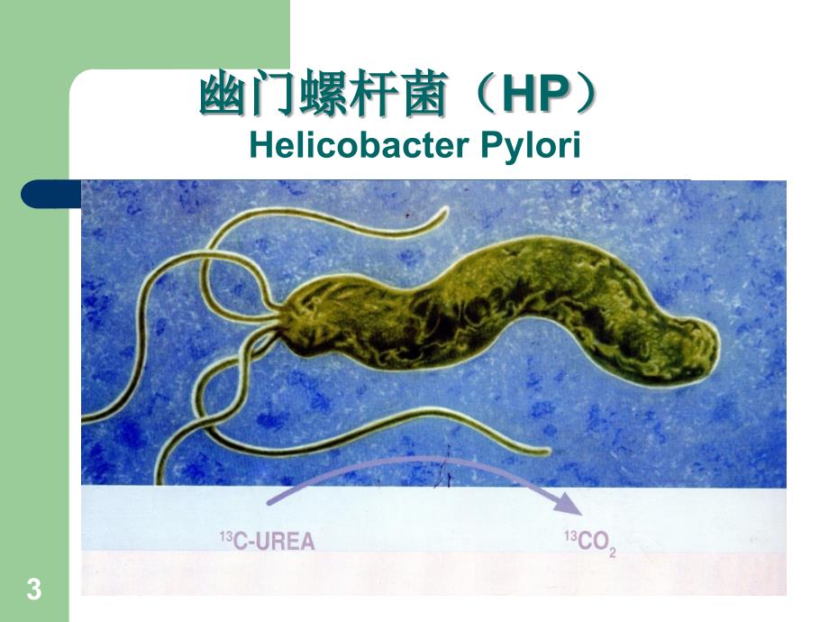 幽门螺杆菌共识解读PPT课件_第3页