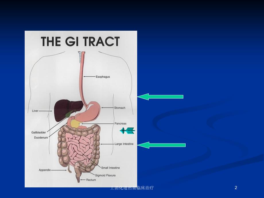 上消化道出血临床治疗培训课件_第2页