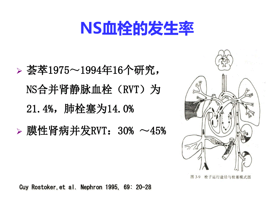 肾病综合征抗凝治疗_第4页