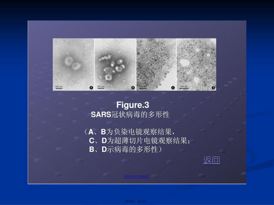 Sars病毒的认知介绍学习教案_第4页