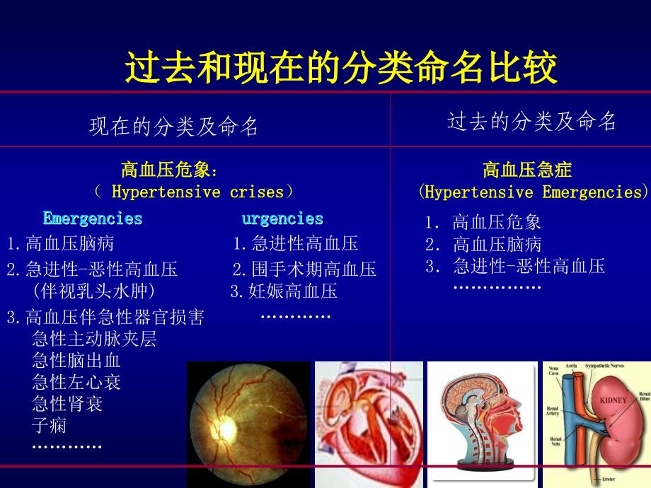 医学课件高血压危象_第4页