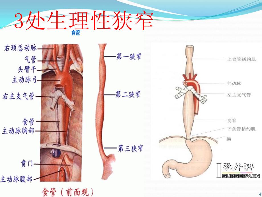 食管癌护理查房课件PPT课件_第4页