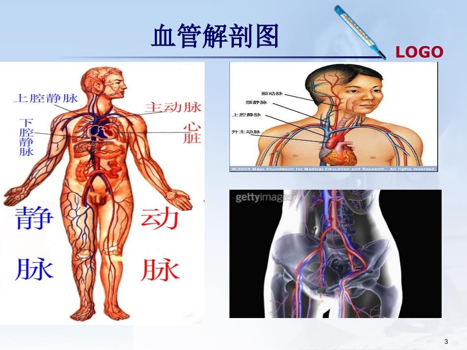 血管外科ppt课件_第3页