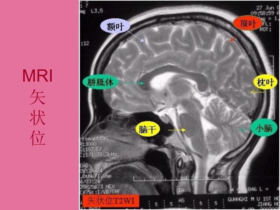 现代头颅影像解剖诊断ppt课件_第5页