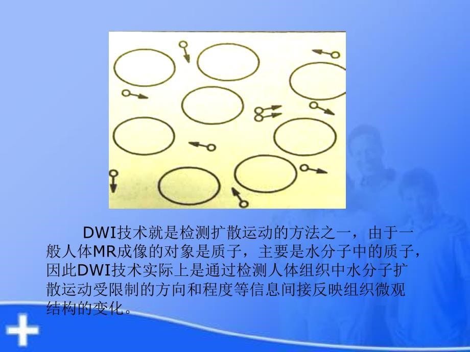 dwi基本原理及其在脑部疾病中的应用精选文档_第5页