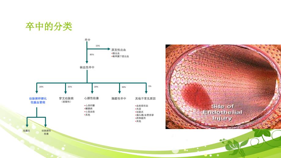 缺血性卒中的诊断策略_第3页