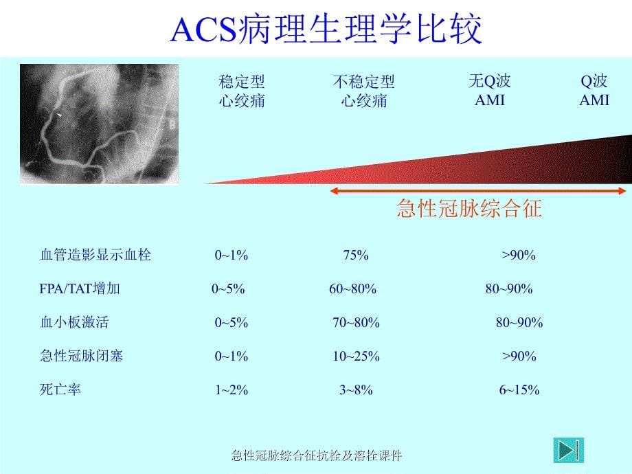 急性冠脉综合征抗栓及溶栓课件_第5页