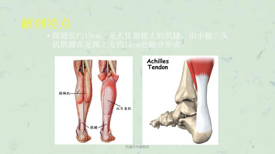 肌腱炎和腱鞘炎课件_第4页