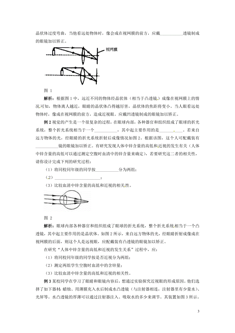 河南省虞城县第一初级中学八年级物理上册 5.4 眼睛和眼镜学案（无答案）（新版）新人教版_第3页