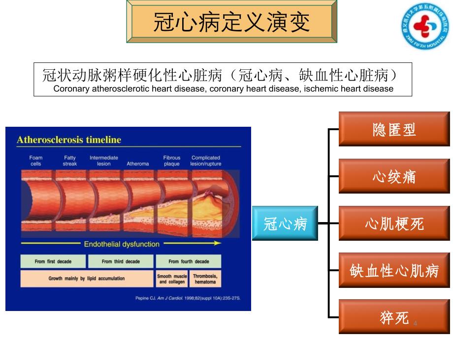 冠心病诊治进展ppt课件_第4页