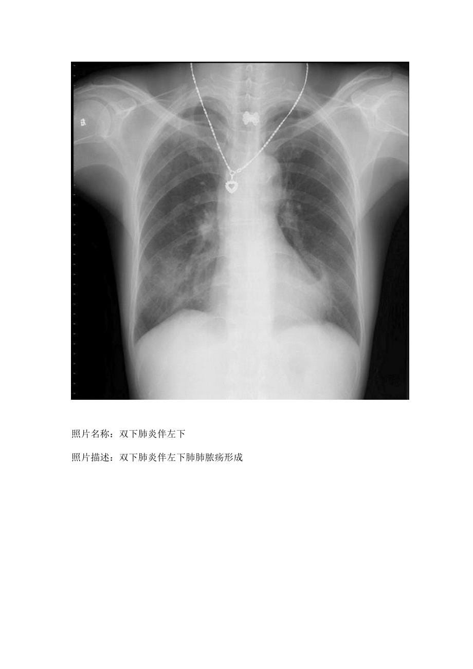 临床X线片病案_第5页