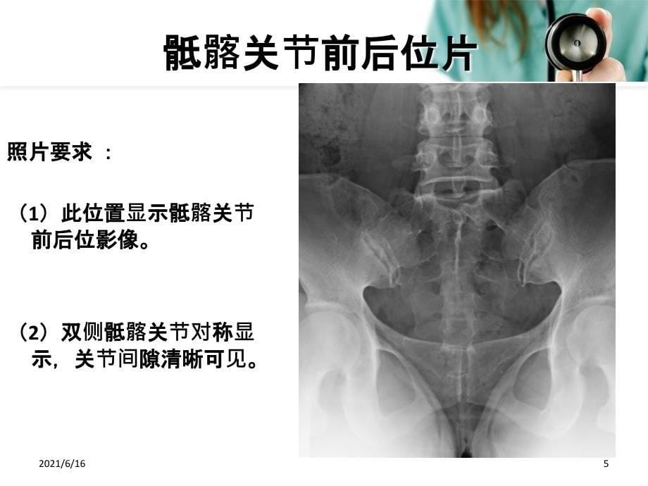 骶髂关节摄影_第5页