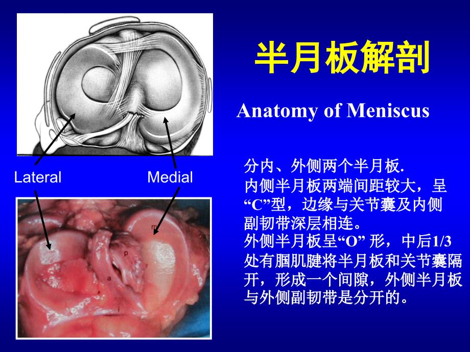 半月板损伤讲课修改版课件_第2页