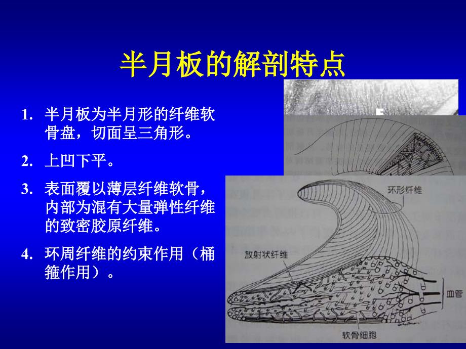 半月板损伤讲课修改版课件_第3页