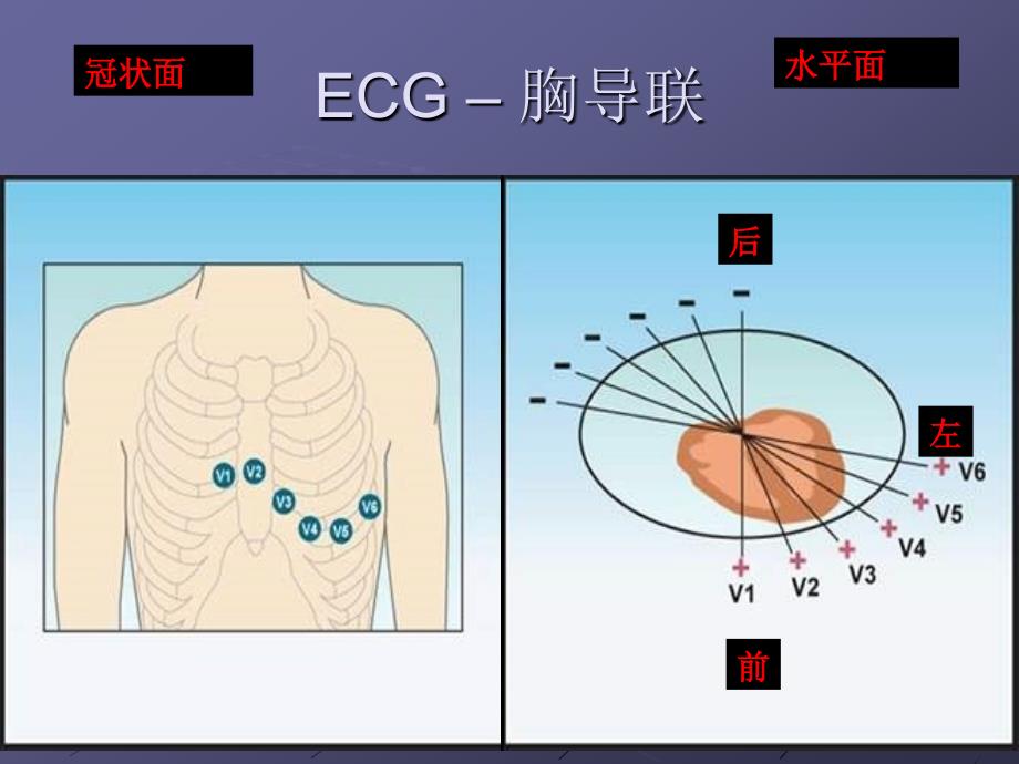 室性期前收缩及室性心动过速的体表心电图定位课件_第4页