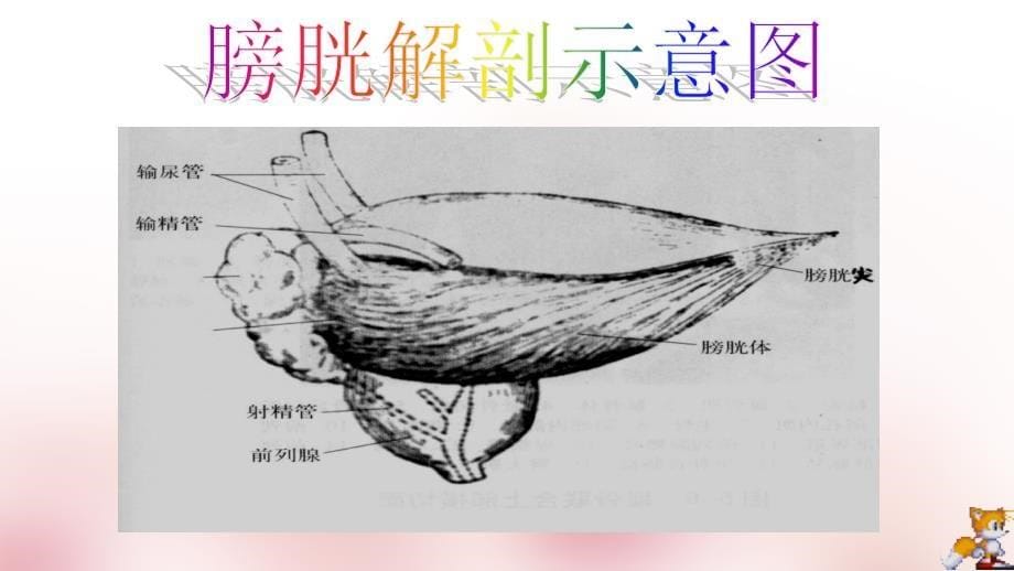 膀胱肿瘤的超声诊断及鉴别诊断ppt课件_第5页