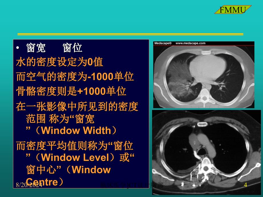 临床医学CT读片胸部课件_第4页