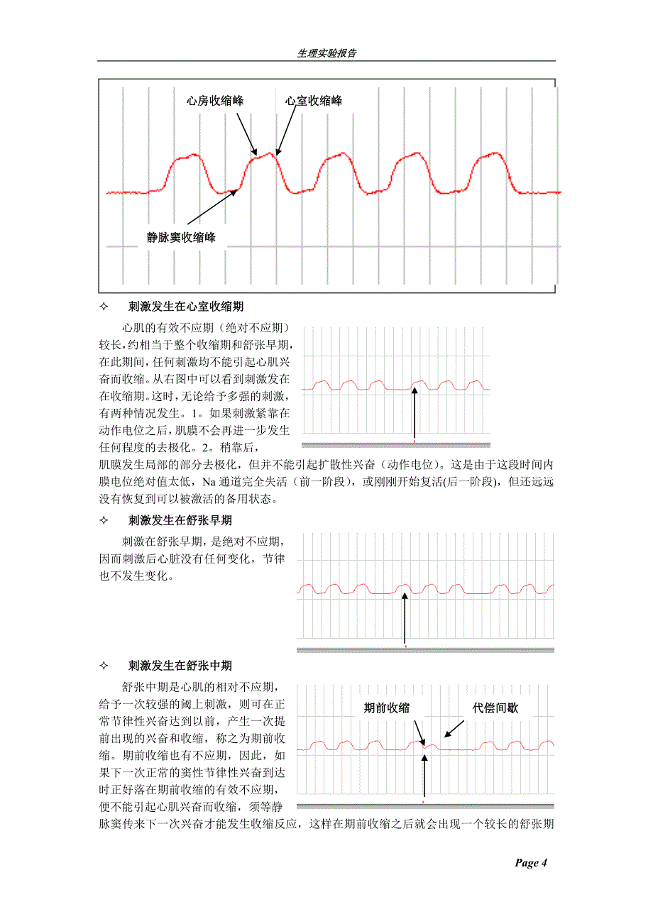 实验报告蟾蜍心博过程的观察与描记蟾蜍心室的期外收缩与代偿间歇_第4页