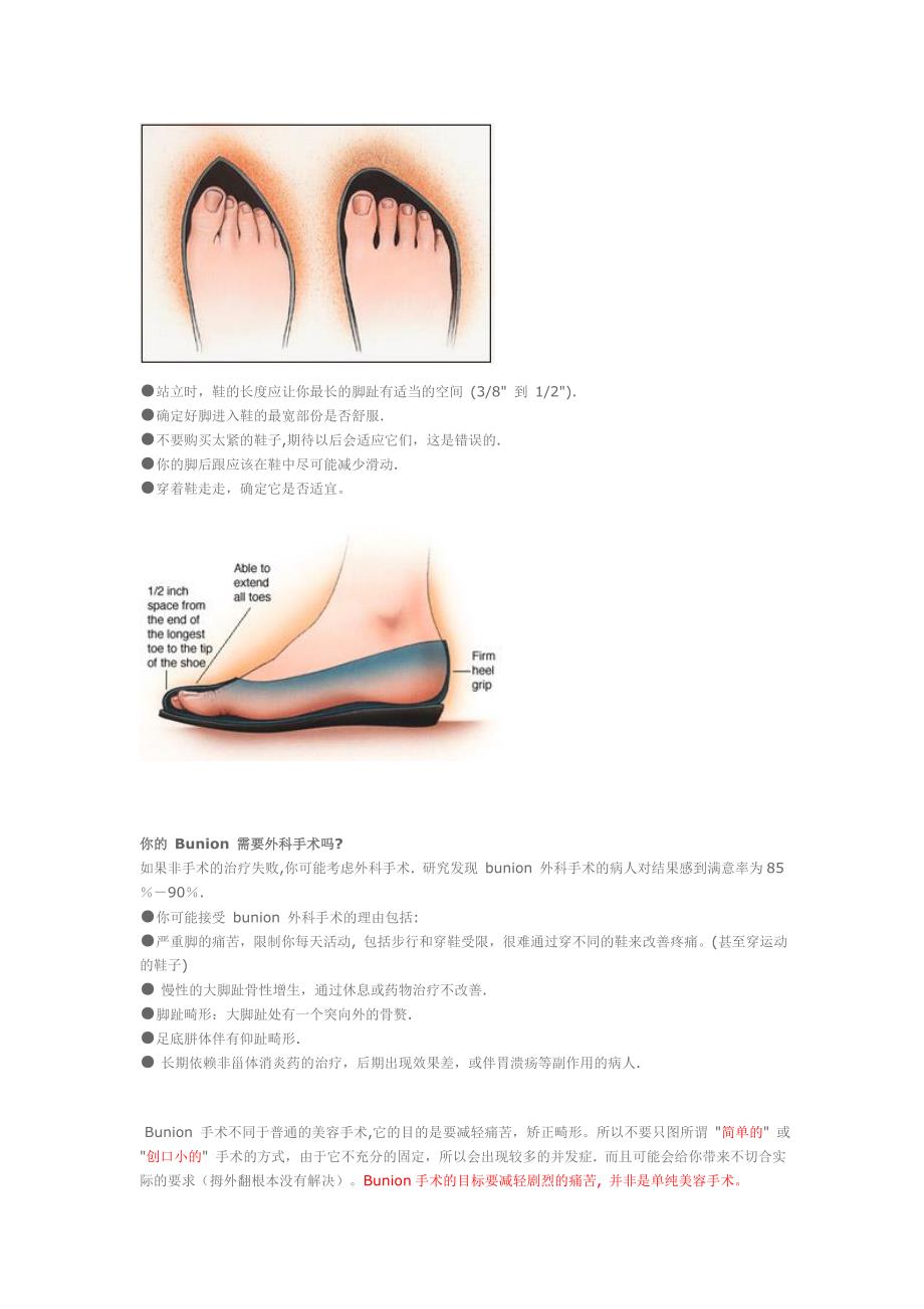 踇外翻小手册.doc_第3页