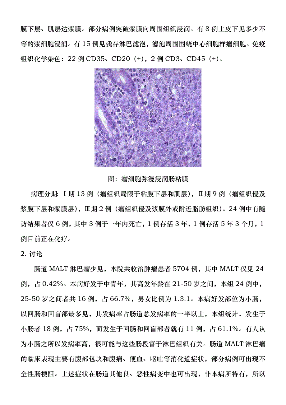 肠道粘膜相关淋巴组织恶性淋巴瘤临床病理分析.doc_第2页