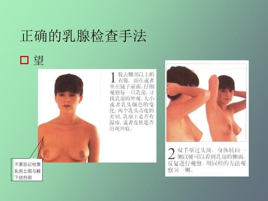 乳腺癌科学防治_第5页