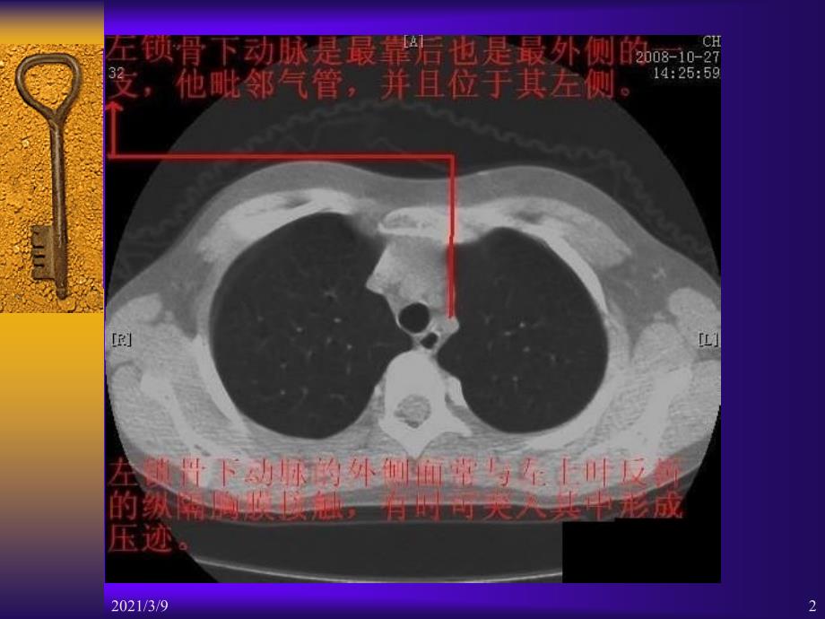 胸部CT断层解剖标注详解PPT课件_第2页