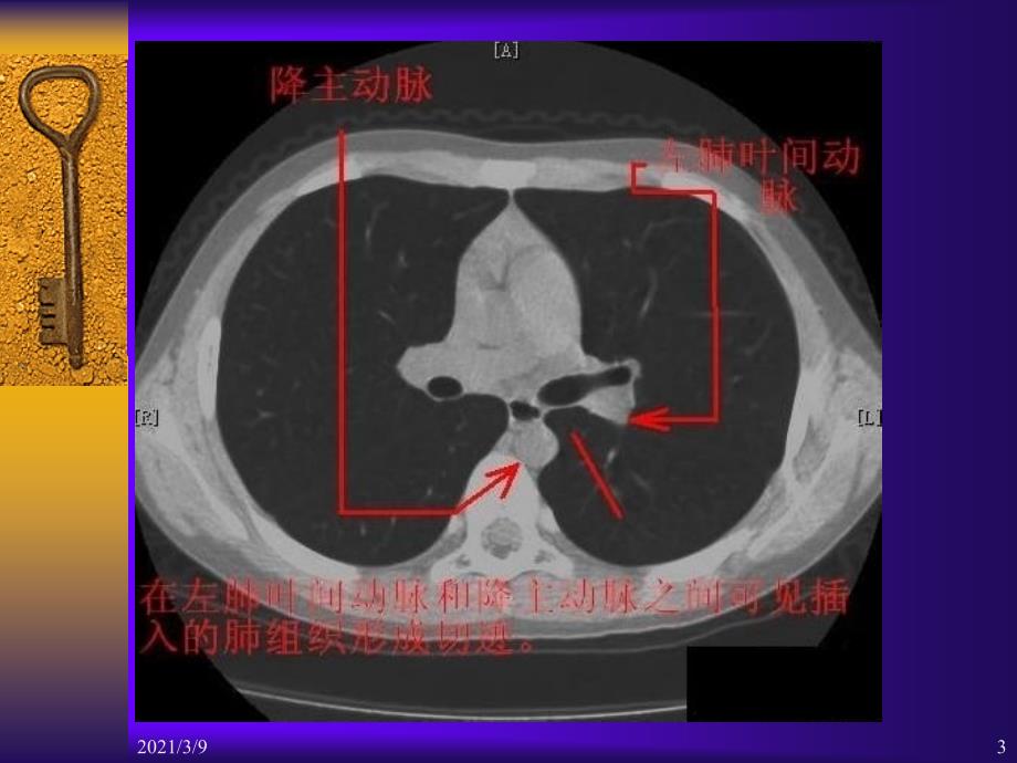 胸部CT断层解剖标注详解PPT课件_第3页