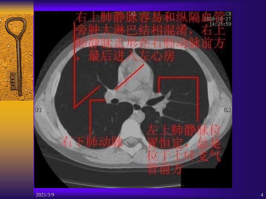 胸部CT断层解剖标注详解PPT课件_第4页