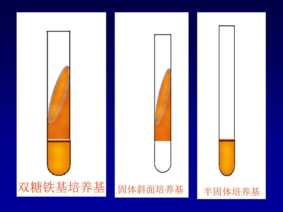 微生物课件-实验-5实验五、肠道杆菌和厌氧菌等_第4页