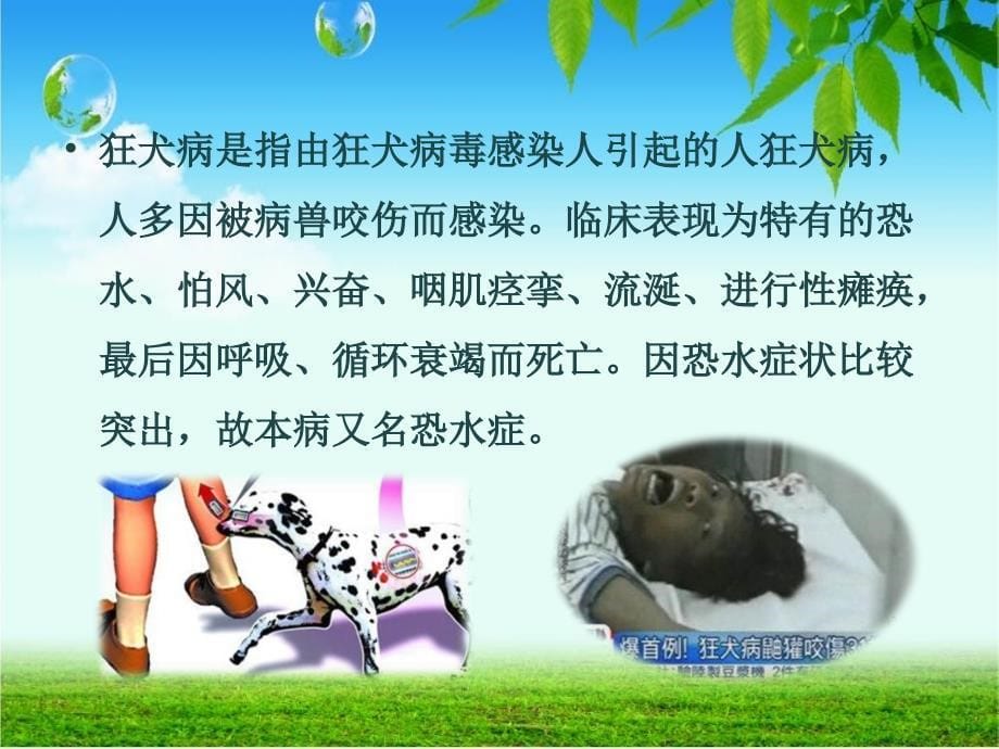 狂犬病和弓形虫病 ()_第5页