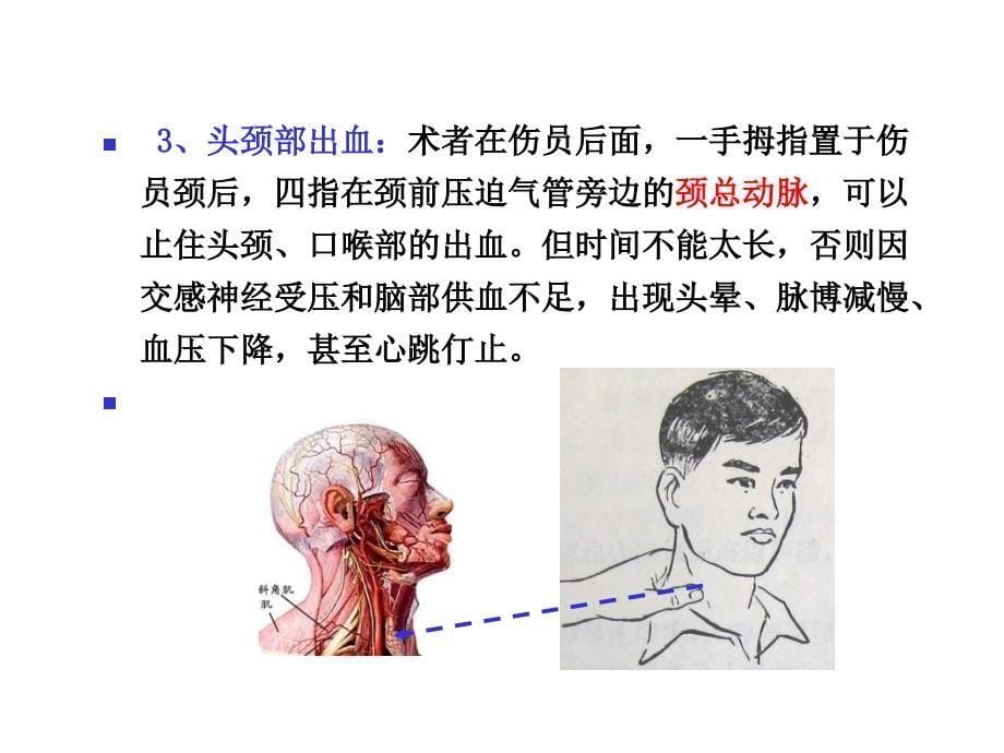 创伤现场急救的四项基本技术_第5页