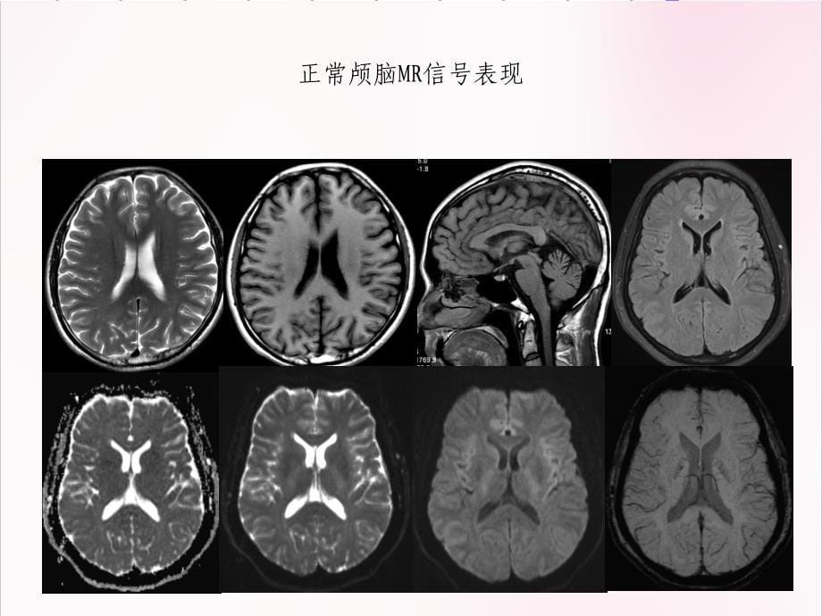 磁共振检查技术规范医学ppt课件_第5页